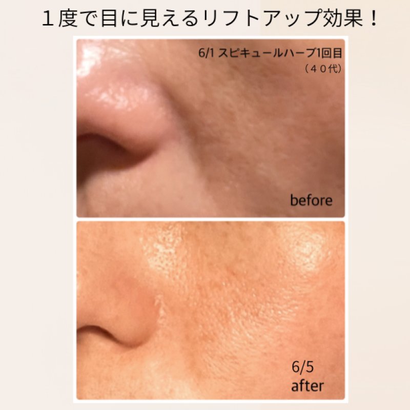 Before After