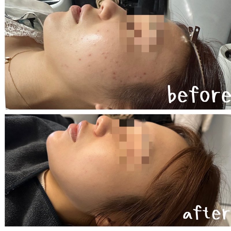 Before After