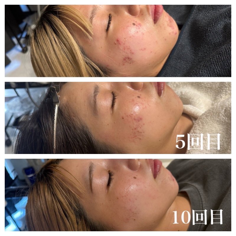 Before After