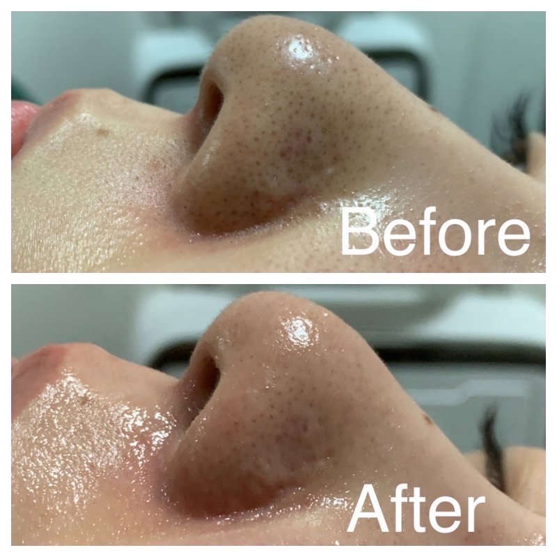 Before After