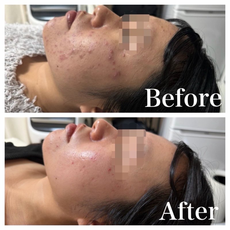 Before After