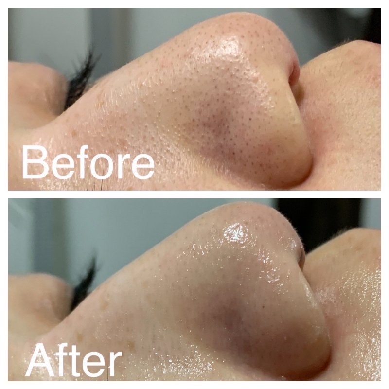 Before After